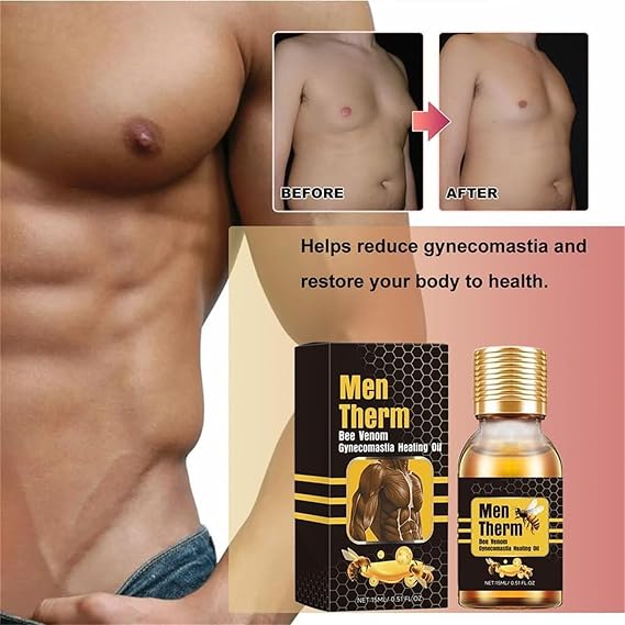Men Threm Bee Venom Gynecomastia Heating Oil