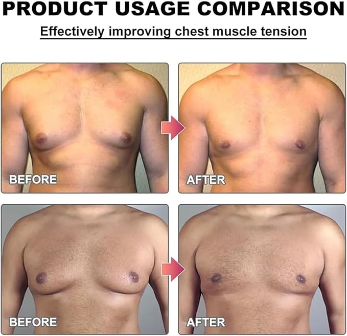 Men Threm Bee Venom Gynecomastia Heating Oil